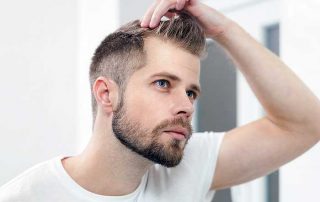 Male Hair Loss - DHT Thinning Hair Virginia